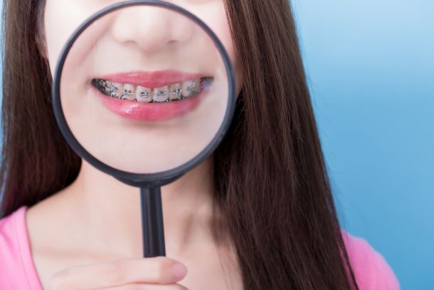 girl holding magnifying glass up to her braces