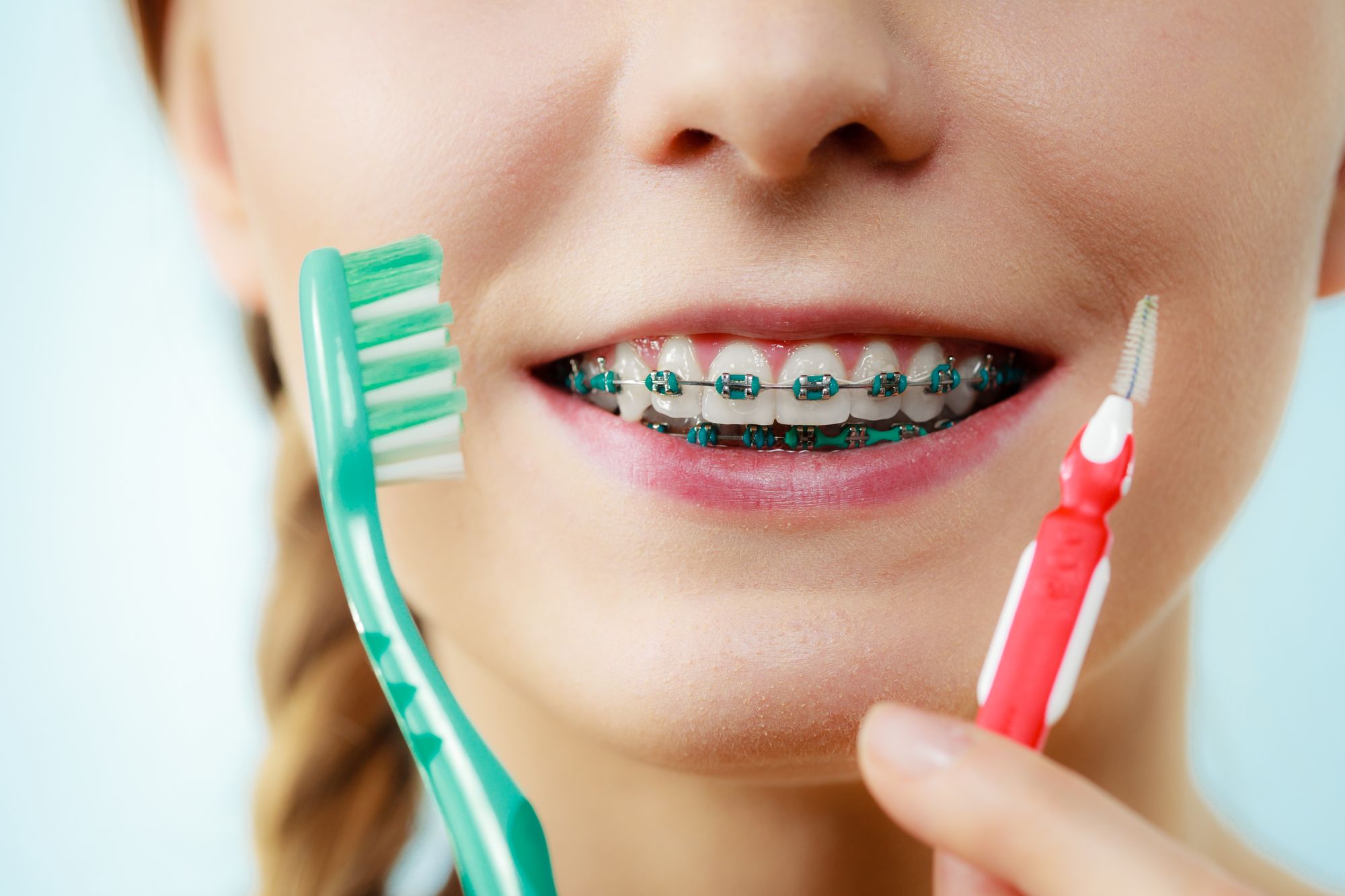 girl with traditional braces holding toothbrush and flosser