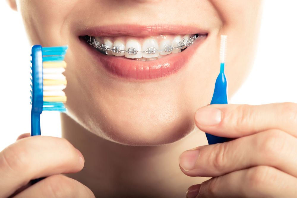 woman with braces holding toothbrush and braces cleaner