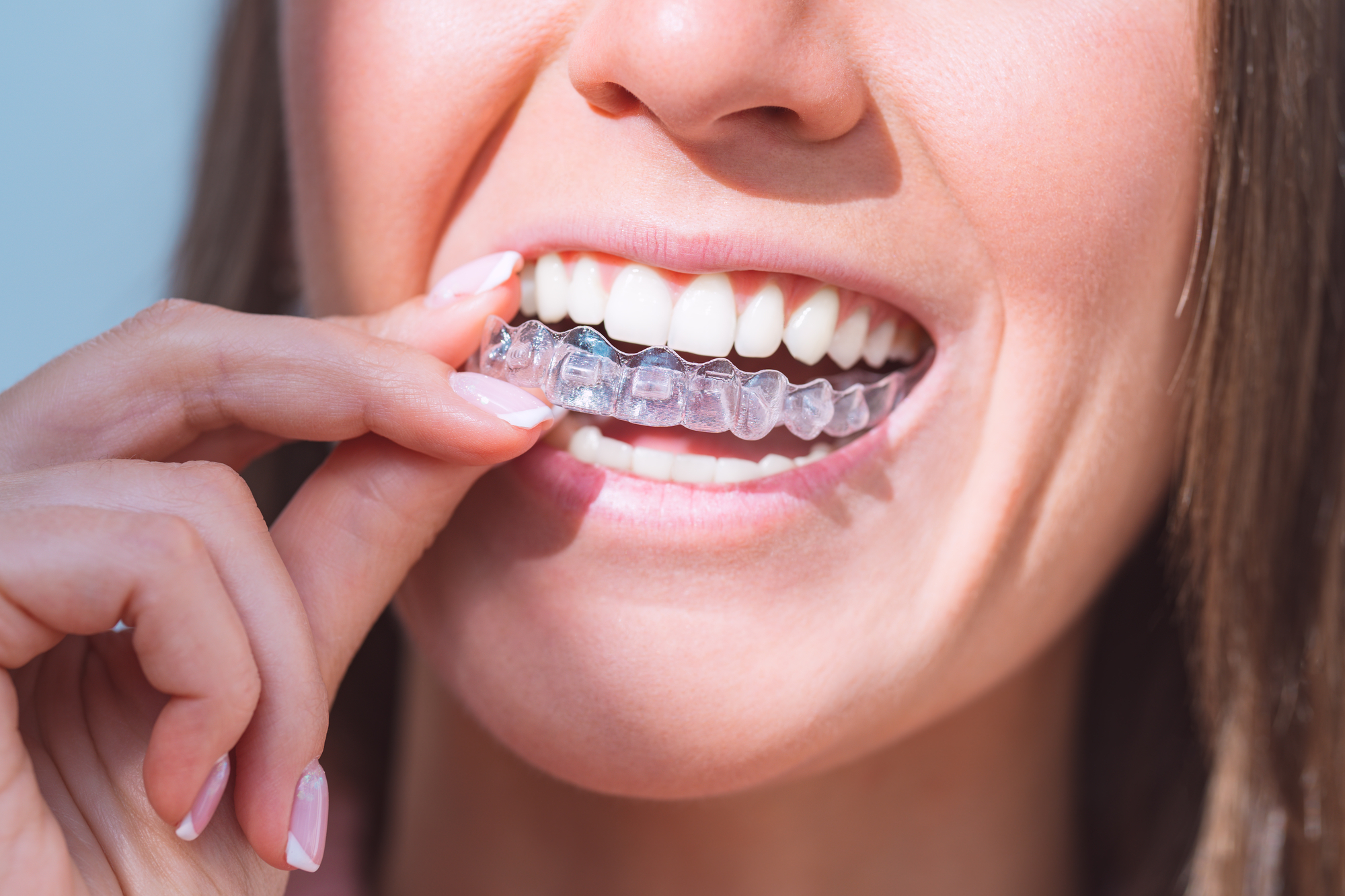 woman putting her Invisalign clear aligners in her mouth