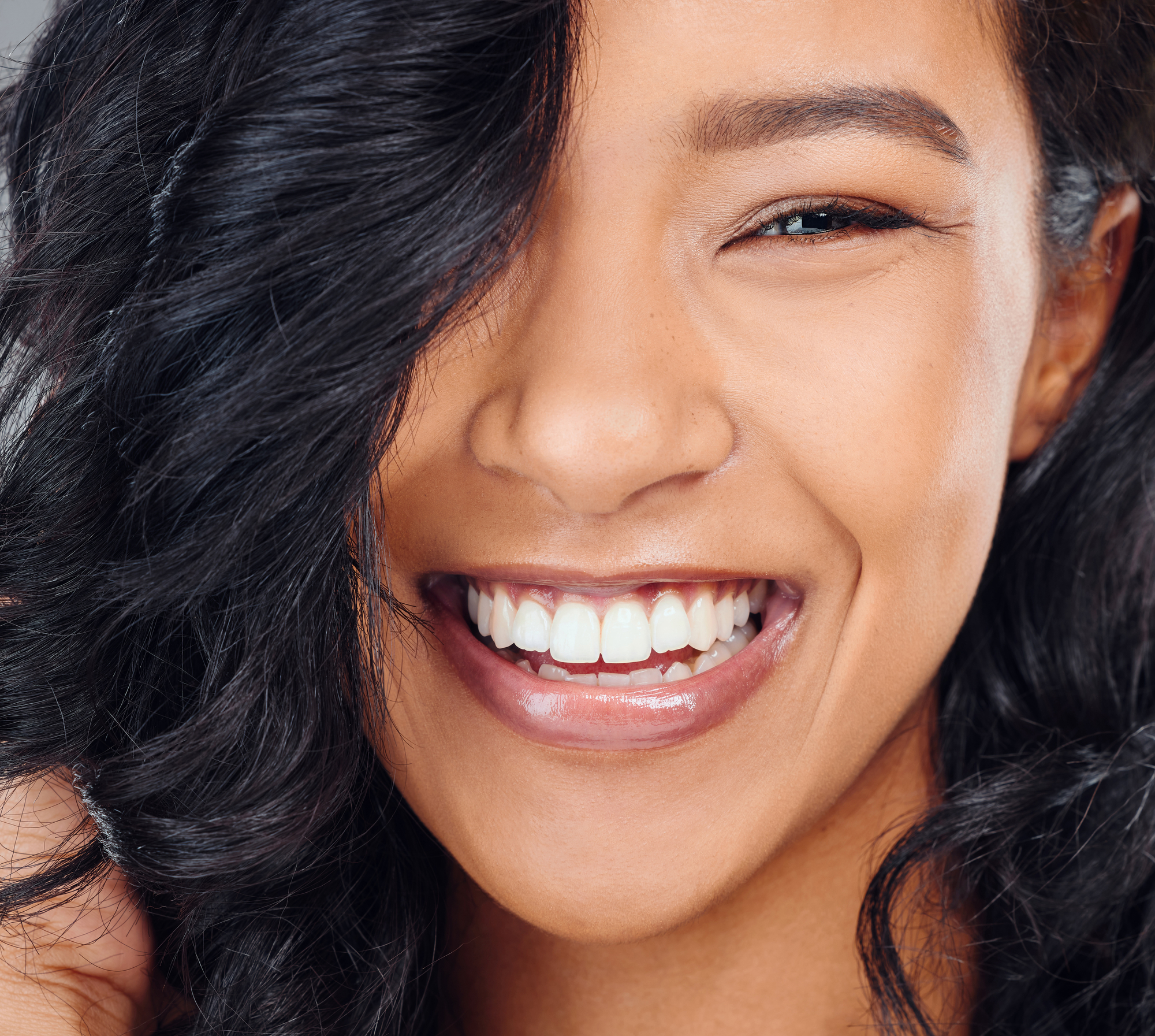 woman with perfect teeth after orthodontic care